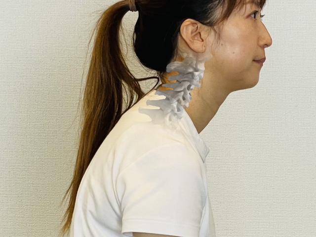 ストレートネックになっている女性