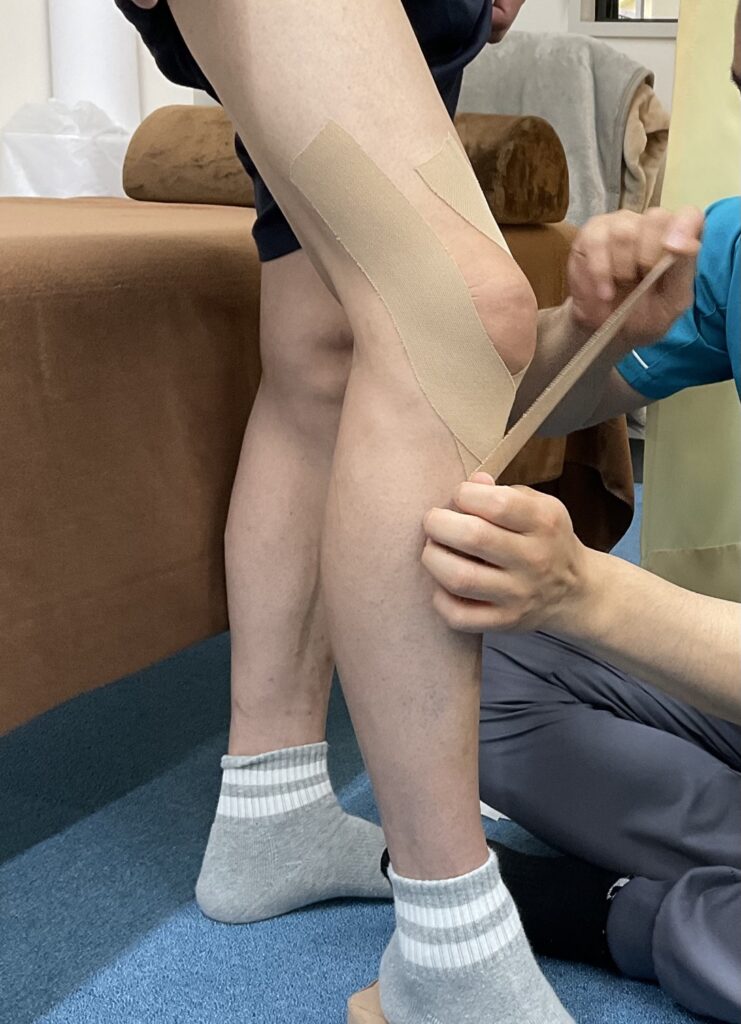 膝のテーピング