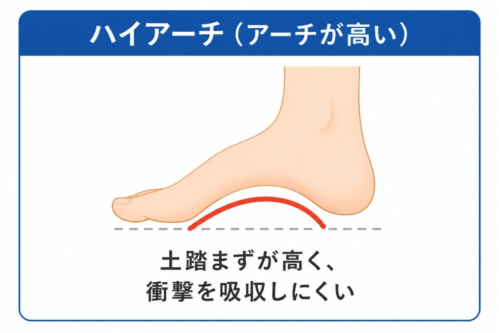 ハイアーチの説明画像