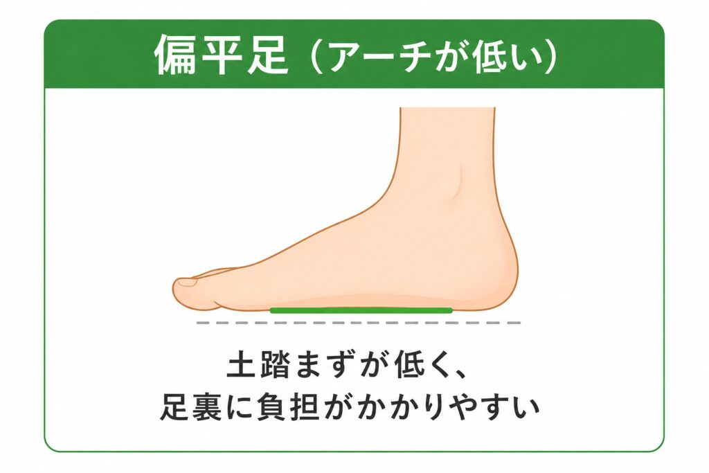 偏平足説明の画像